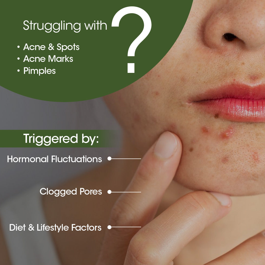 Eladi Acne Control Combo